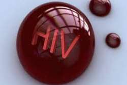 راهی جدید برای درمان ایدز (HIV) کشف شد